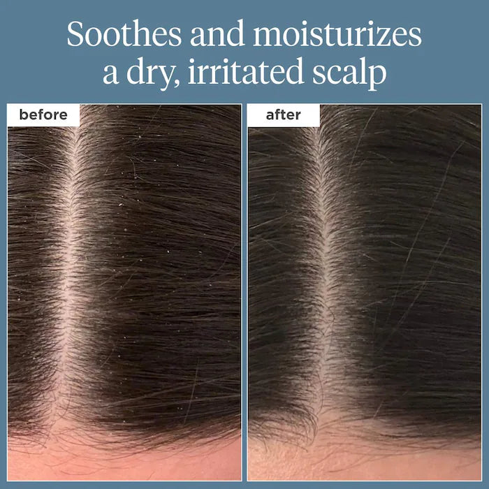 BRIOGEO Scalp Revival™ Rosemary Pre-Wash Scalp and Hair Oil 3.4 fl oz