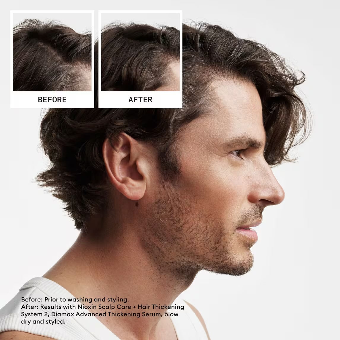 NIOXIN System 2 a Kit Scalp + Hair Thickening trial size