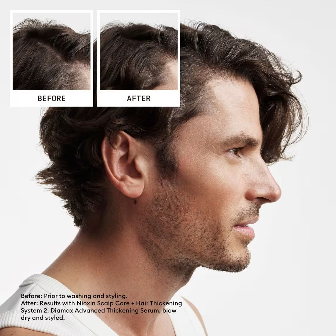 NIOXIN System 2 Conditioner Scalp + Hair Thickening 33.9 fl oz