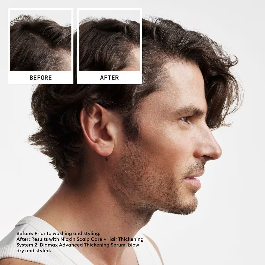 NIOXIN System 2 Shampoo and Conditioner Duo Scalp + Hair Thickening 33.8/ 1 L fl oz